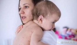 宝宝吃黄皮瓜过敏吗